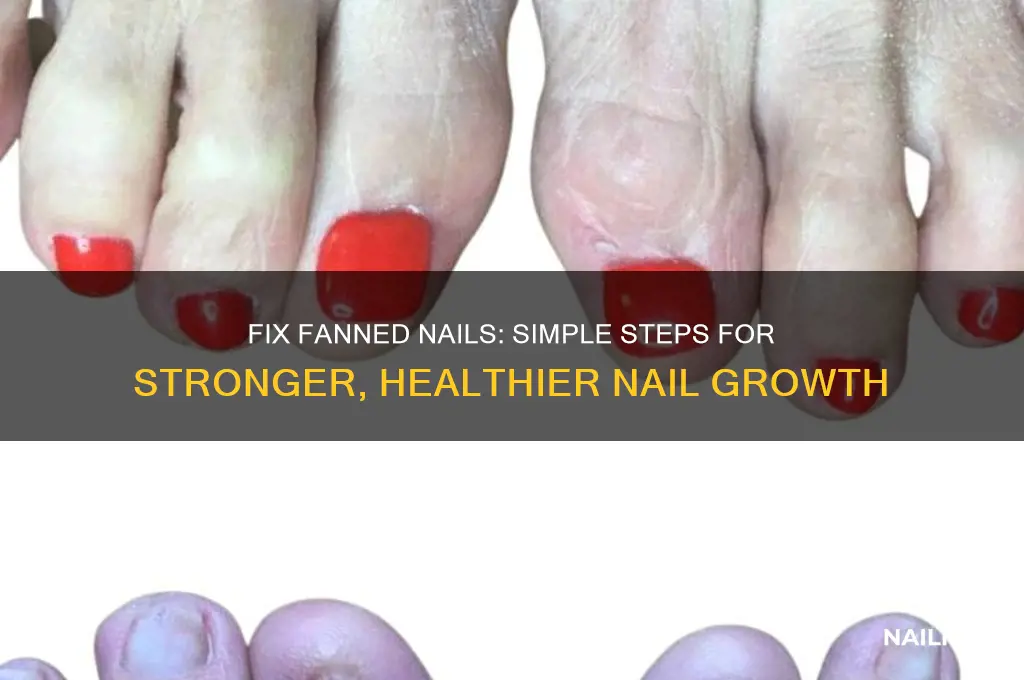 how to correct fanned nails
