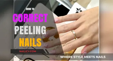 Effective Remedies to Repair and Prevent Peeling Nails Naturally