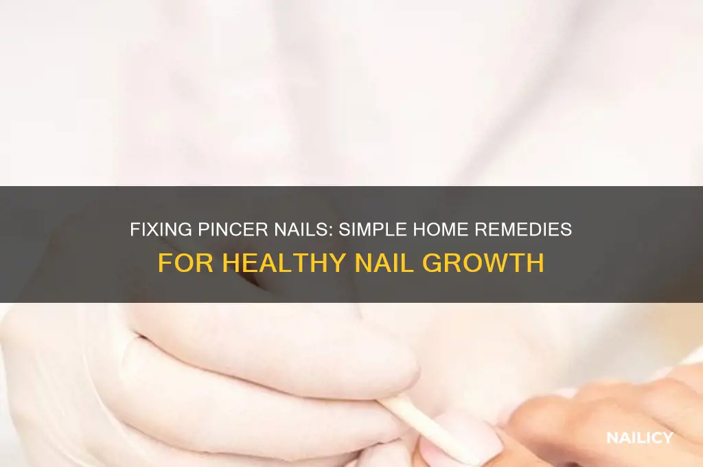 how to correct pincer nails at home