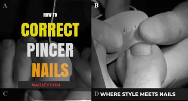 Effective Tips to Correct and Manage Pincer Nails at Home