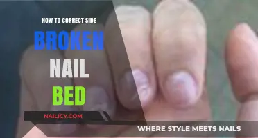 Quick Fix for a Side-Broken Nail Bed: Healing Tips and Tricks