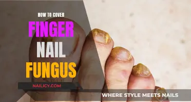 Concealing Nail Fungus: Camouflaging and Curing Your Infection