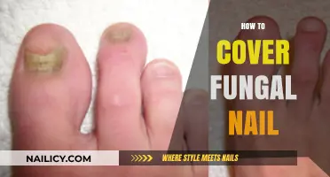 Effective Ways to Conceal and Treat Fungal Nail Infections