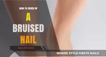Quick Fixes: Concealing Bruised Nails with Easy DIY Techniques