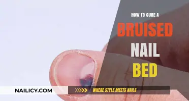 Heal Your Bruised Nail Bed: Quick and Effective Remedies