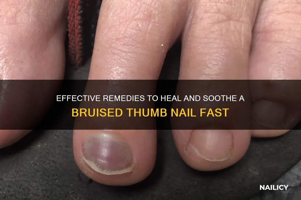 how to cure a bruised thumb nail