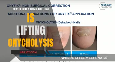 Fixing Fingernail Lifting: Treating Onycholysis at Home