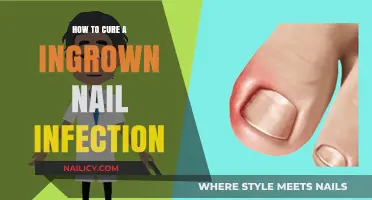 Effective Remedies to Treat and Prevent Ingrown Nail Infections Fast