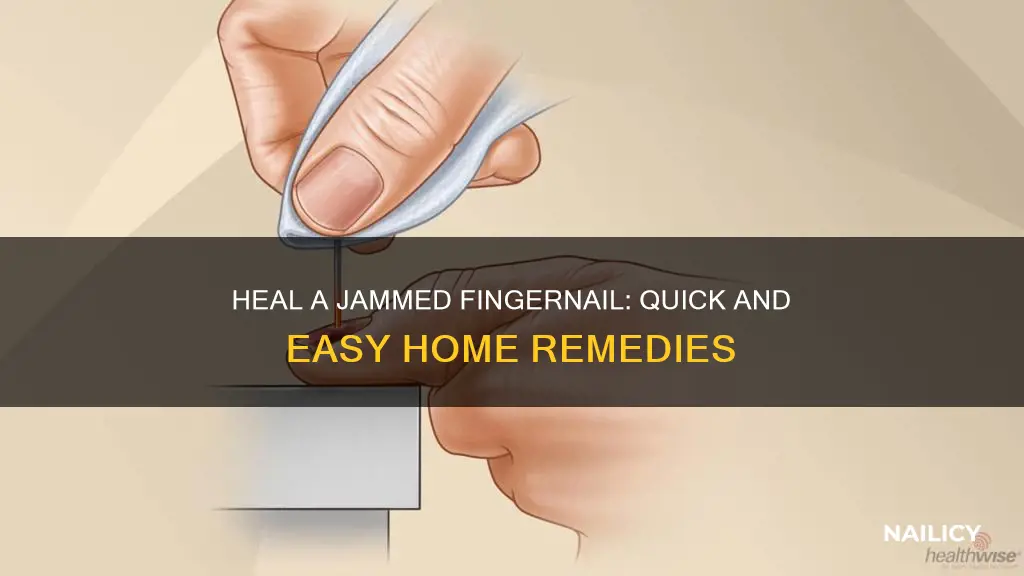 how to cure a jammed finger nail
