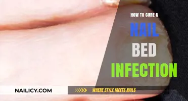 Effective Remedies to Treat and Prevent Nail Bed Infections Fast