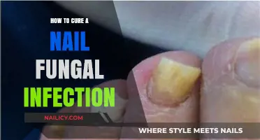 Effective Remedies to Treat and Eliminate Nail Fungal Infections Fast