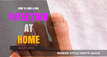 Effective Home Remedies to Treat and Cure Nail Infections Fast