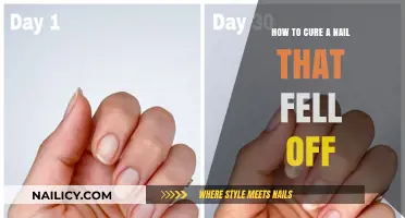Healing a Lost Nail: Effective Steps for Recovery and Regrowth