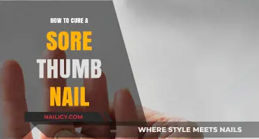 Effective Remedies to Heal and Soothe a Sore Thumb Nail Fast