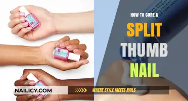 Quick Fixes for Split Thumb Nails: Healing Tips and Tricks