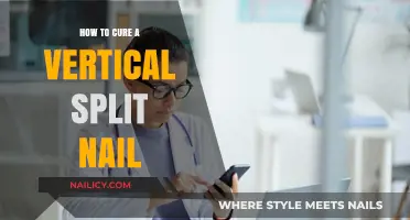 Heal Vertical Split Nails: Quick Fixes and Prevention Tips
