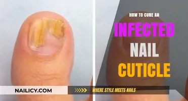 Effective Remedies to Heal and Treat Infected Nail Cuticles Fast