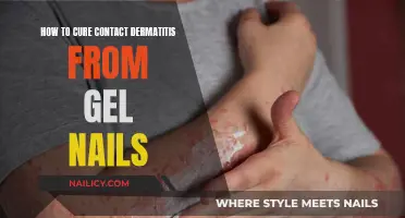 Gel Nails and Dermatitis: Curing Skin Irritation