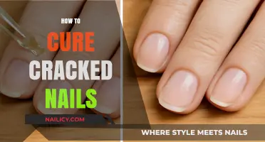 Effective Remedies to Repair and Strengthen Cracked Nails Fast