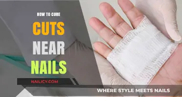 Healing Cuts Near Nails: Quick and Easy Methods