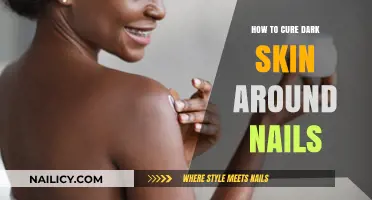 Effective Remedies to Brighten Dark Skin Around Your Nails Naturally