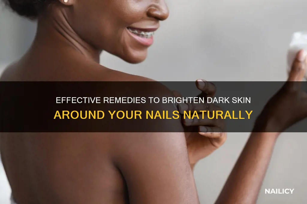 how to cure dark skin around nails