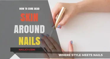 Effective Remedies to Heal and Remove Dead Skin Around Nails
