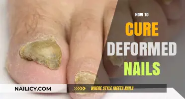 Effective Remedies to Restore and Repair Deformed Nails Naturally