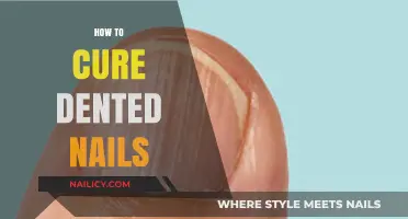 Fix Dented Nails Fast: Simple DIY Solutions for Smooth, Healthy Nails