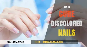 Effective Remedies to Restore and Brighten Discolored Nails Naturally