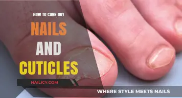 Nourish and Repair: Effective Remedies for Dry Nails and Cuticles