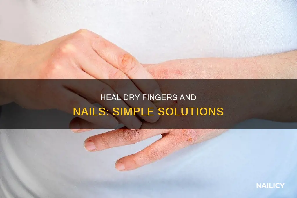 how to cure extream dry fingers and finger nails