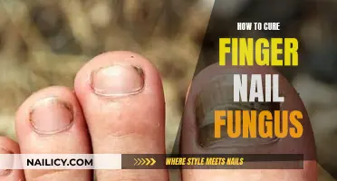 Effective Home Remedies for Finger Nail Fungus