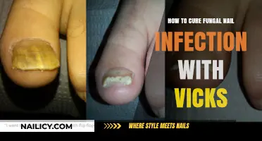 Effective Vicks Vaporub Remedy for Fungal Nail Infections: A Complete Guide