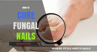 Effective Remedies to Treat and Prevent Fungal Nail Infections