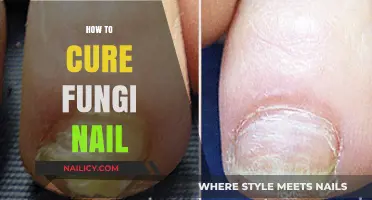 Effective Remedies to Treat and Cure Fungal Nail Infections Fast