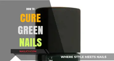 Effective Remedies to Treat and Prevent Green Nails Naturally