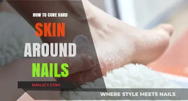 Effective Remedies to Soften and Heal Hard Skin Around Nails