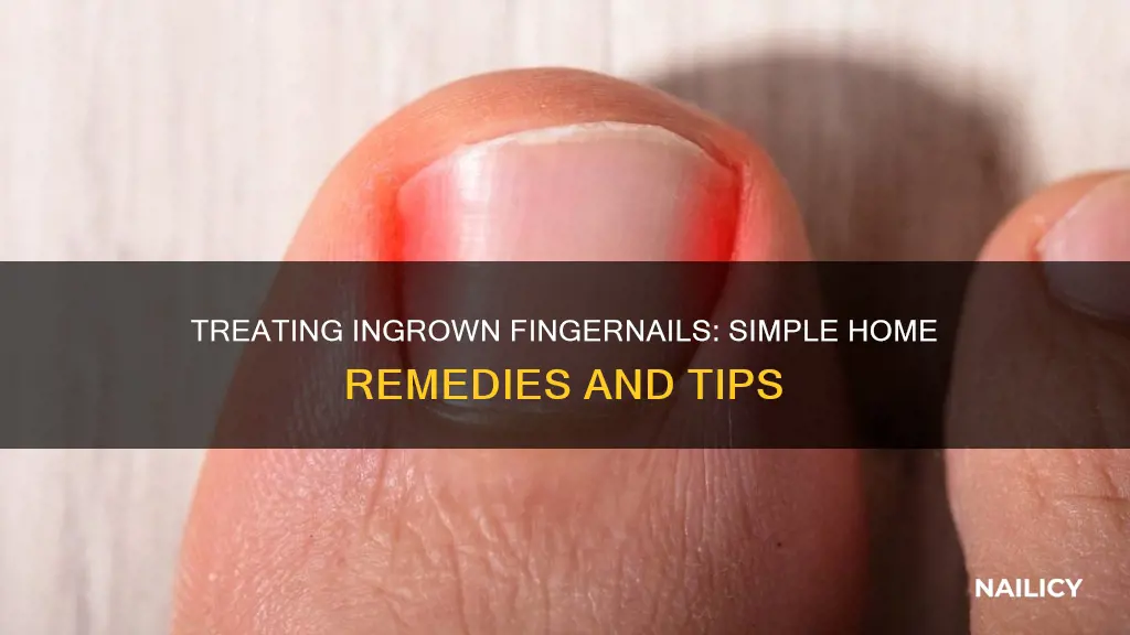 how to cure in grown finger nails