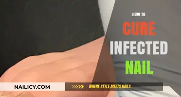 Effective Remedies to Heal and Treat Infected Nails Fast