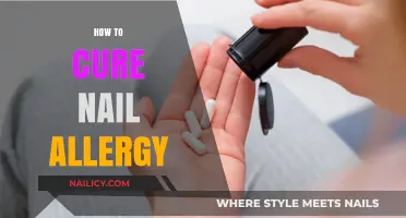 Effective Remedies to Heal and Prevent Nail Allergy Reactions