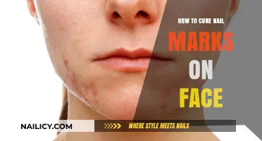 Effective Remedies to Heal and Remove Nail Marks on Your Face