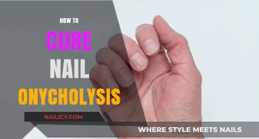 Effective Remedies to Treat and Prevent Nail Onycholysis Naturally