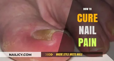 Effective Remedies to Relieve Nail Pain and Promote Healing Fast