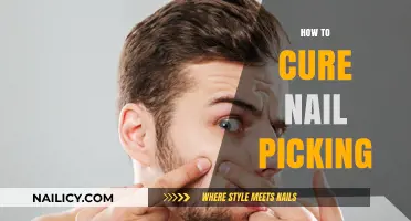 Stop Nail Picking: Effective Strategies for Healthy, Healed Hands