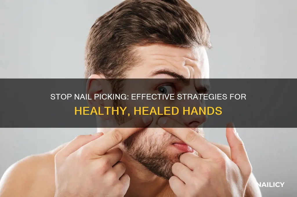 how to cure nail picking