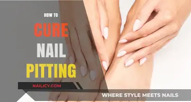 Effective Remedies for Nail Pitting: Restore Smooth, Healthy Nails Fast