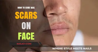 Effective Remedies to Heal and Remove Nail Scars on Your Face
