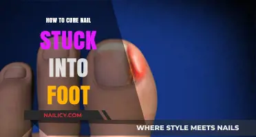 Effective Remedies for Removing a Nail Stuck in Your Foot Safely
