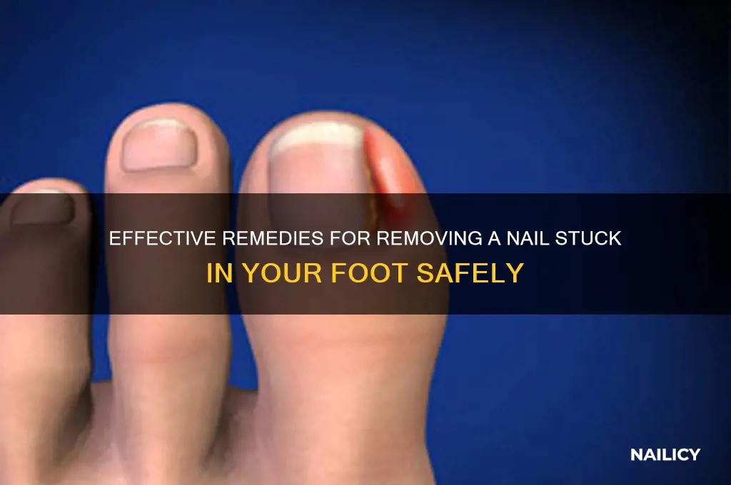 how to cure nail stuck into foot
